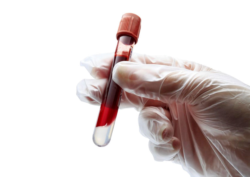 KAN VE İDRAR TAHLİLİ